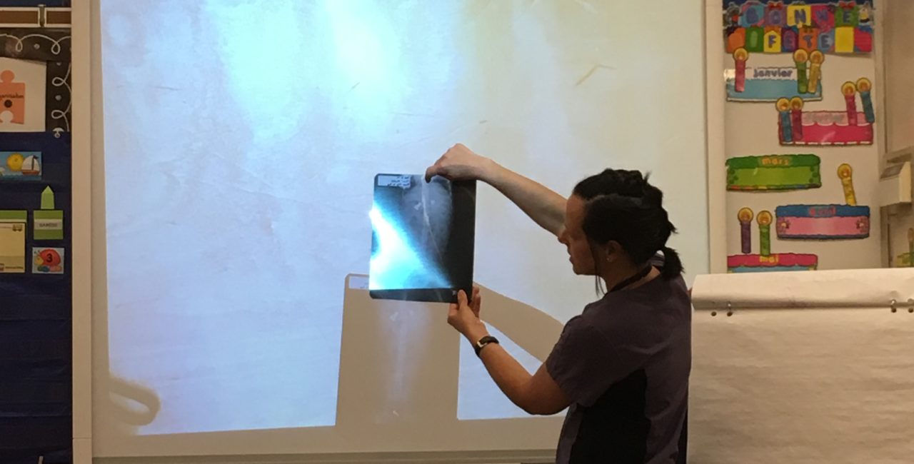 Woman showing x-ray to a group of kids